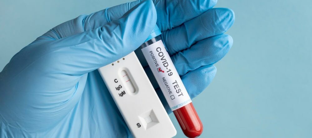 Testy na COVID-19. Czym się różnią testy na koronawirusa, jakie są rodzaje i jak działają?