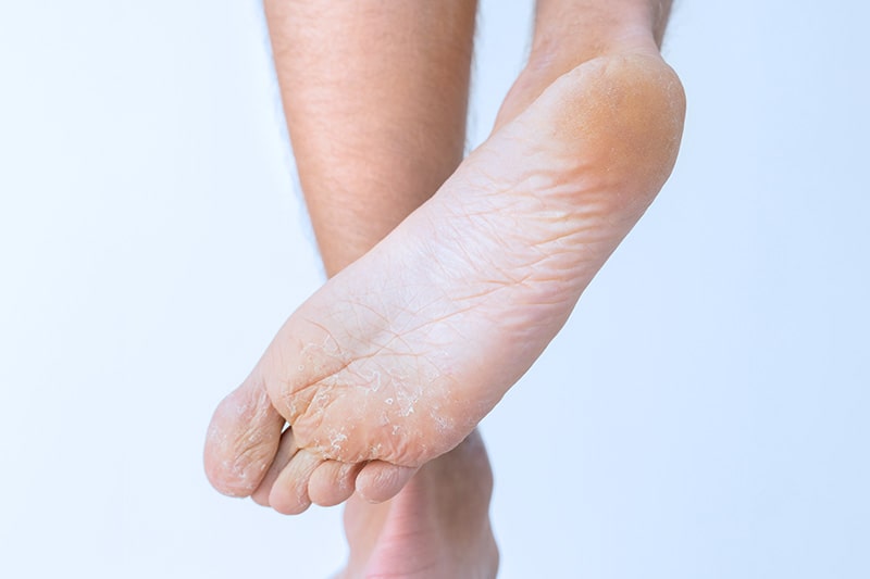 Choroby widoczne na stopach – na co chorujesz?