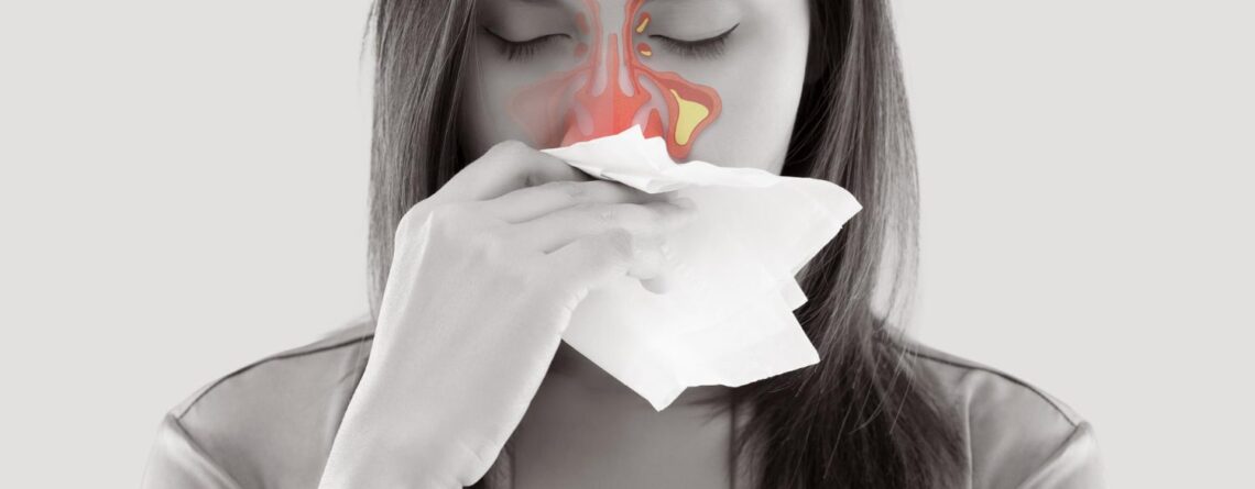 Zapalenie zatok — objawy, domowe sposoby